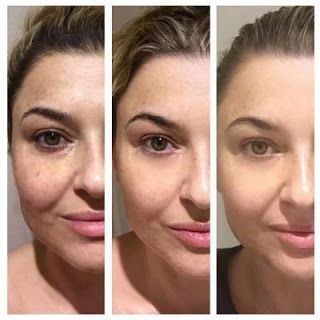 Anti - Ageing