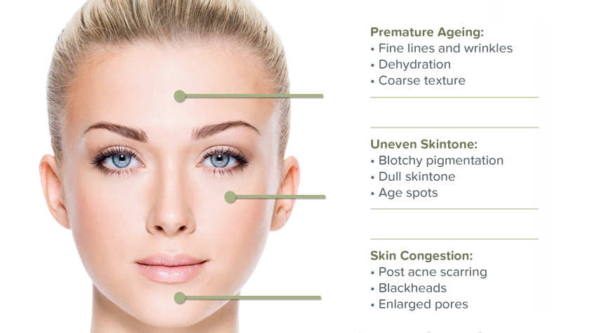 Microdermabrasion